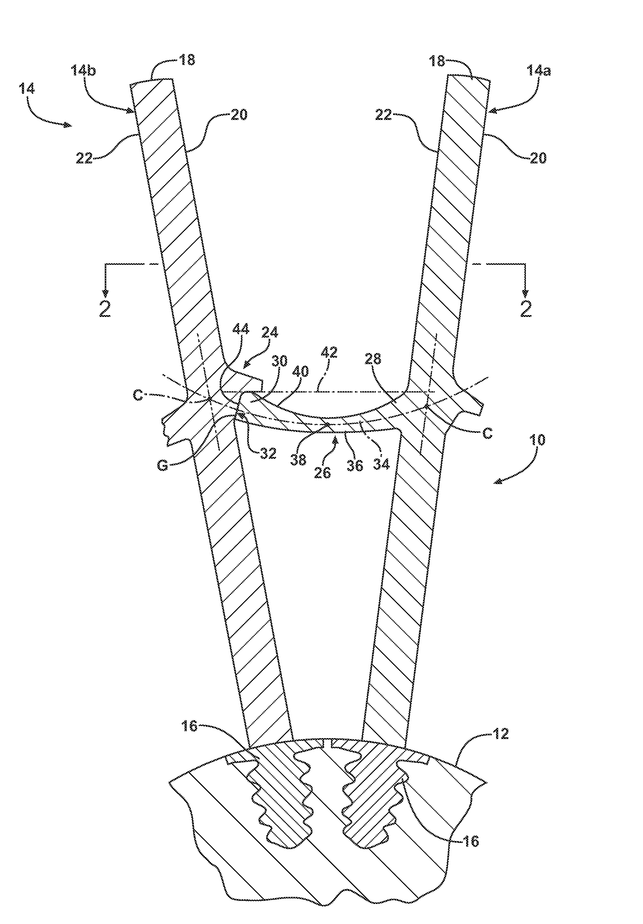 Turbine Blade Damping Device With Controlled Loading