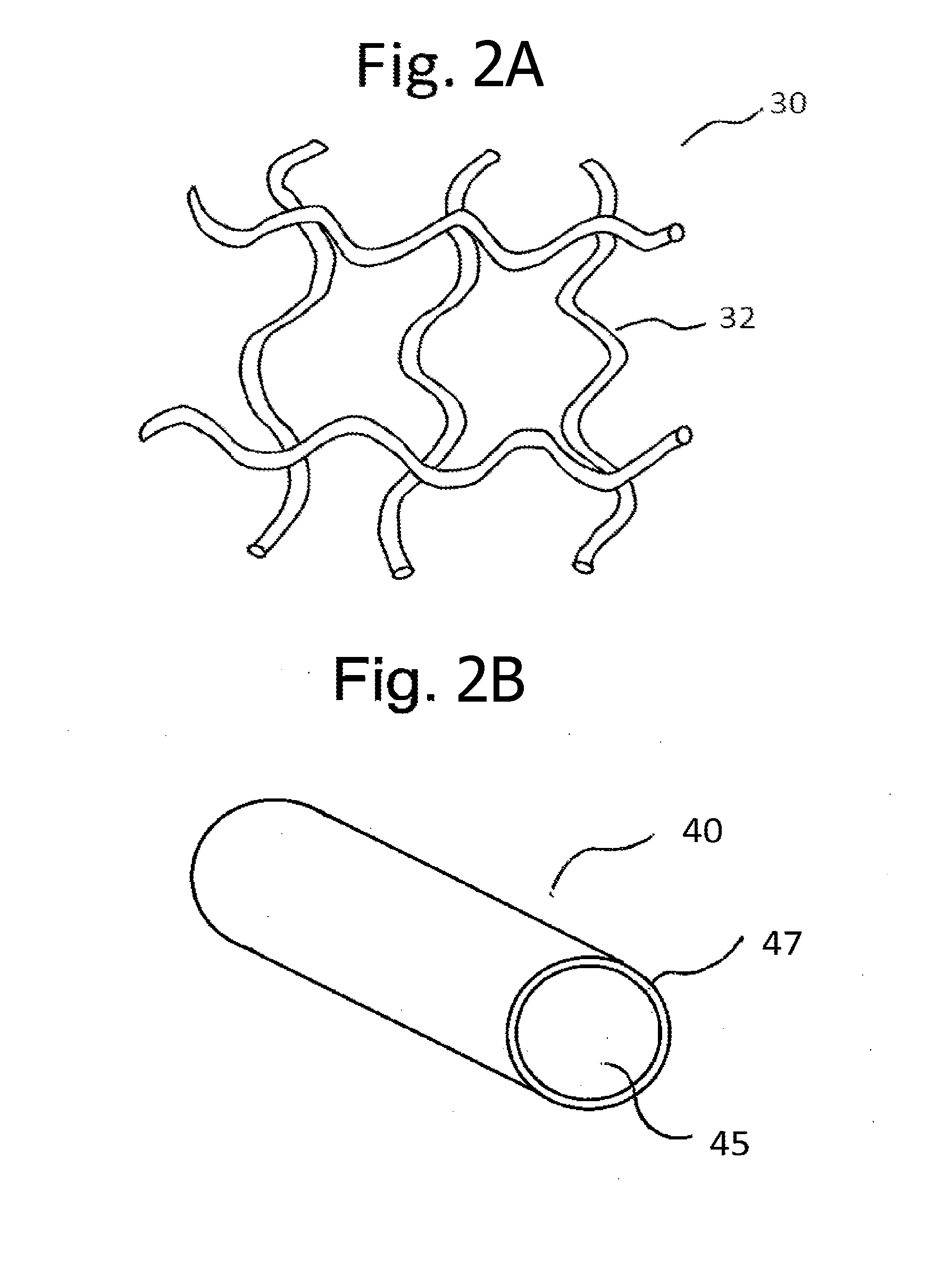 Biodegradable articles and methods for treatment of pelvic floor disorders including extracellular matrix material