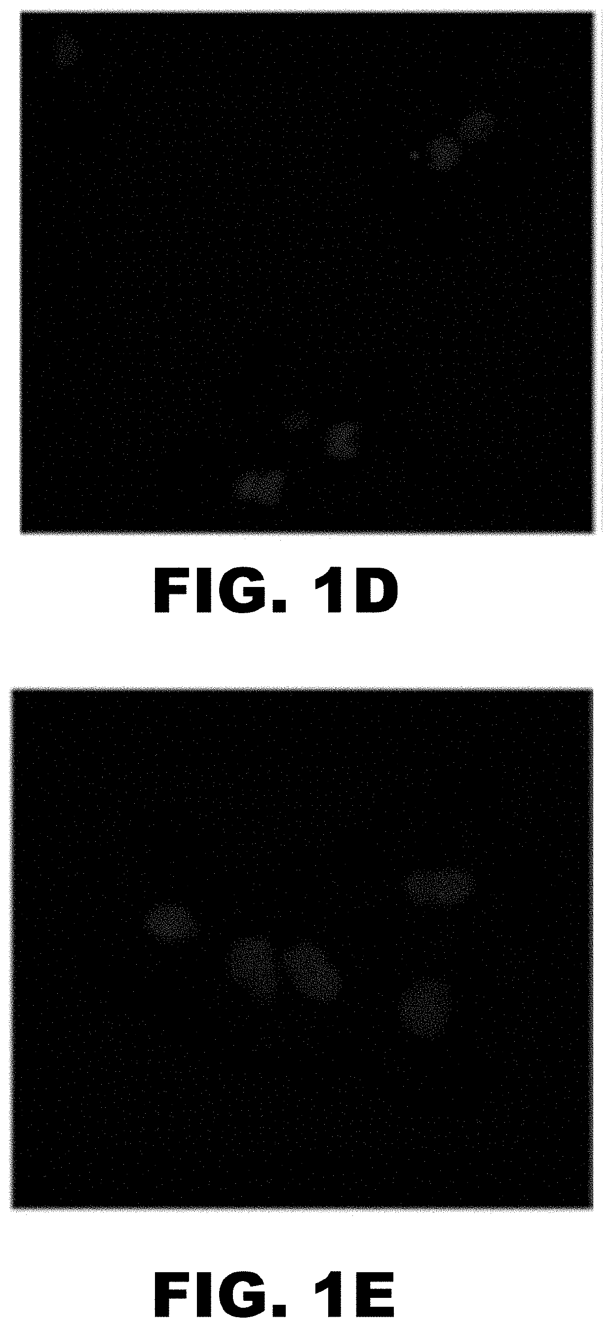 Noninvasive imaging of focal atherosclerotic lesions using fluorescence molecular tomography