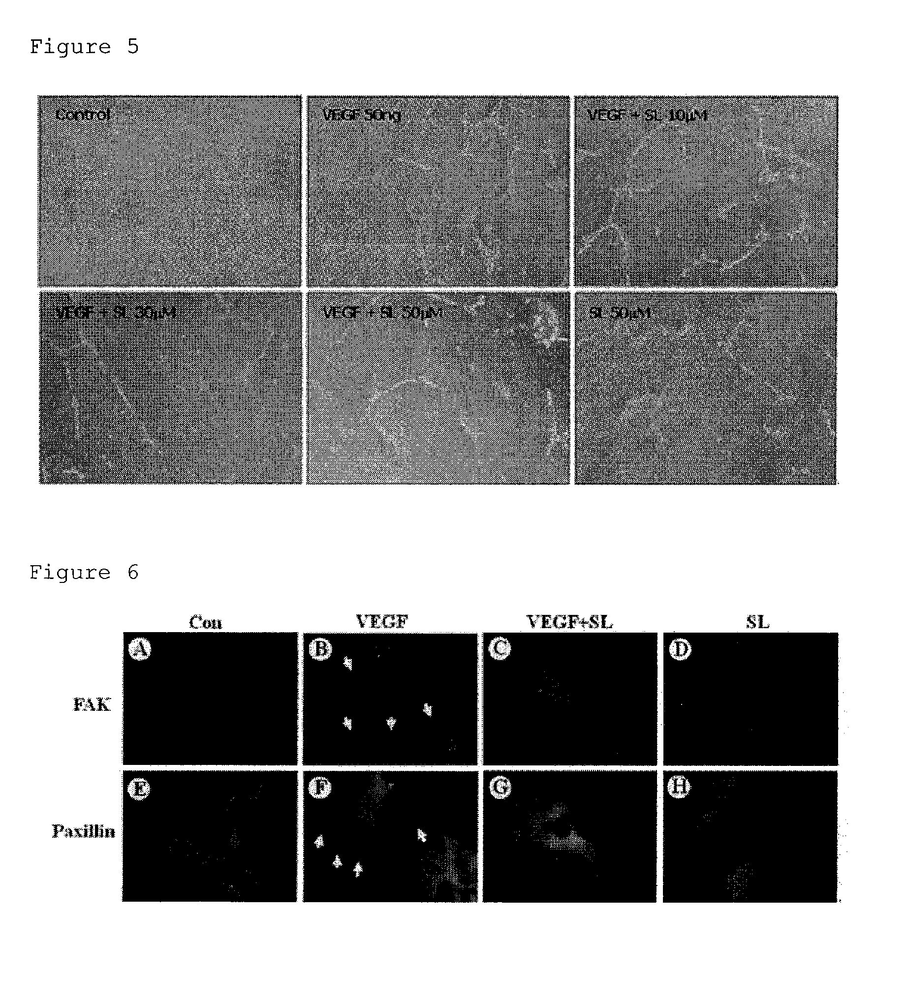 Composition for prevention or treatment of eye diseases