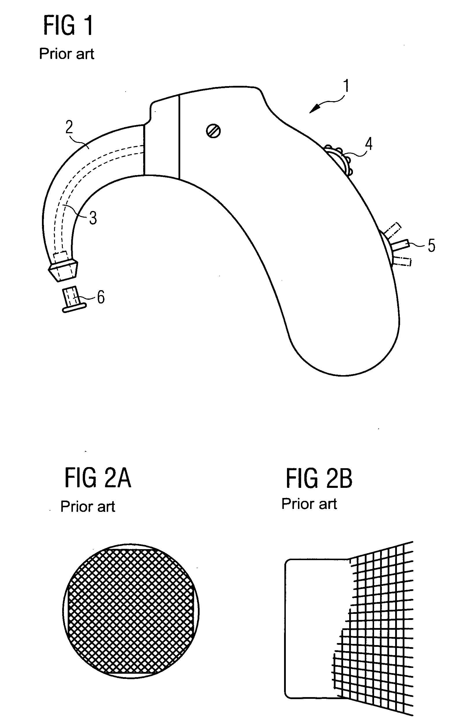 Hearing aid with acoustic damper