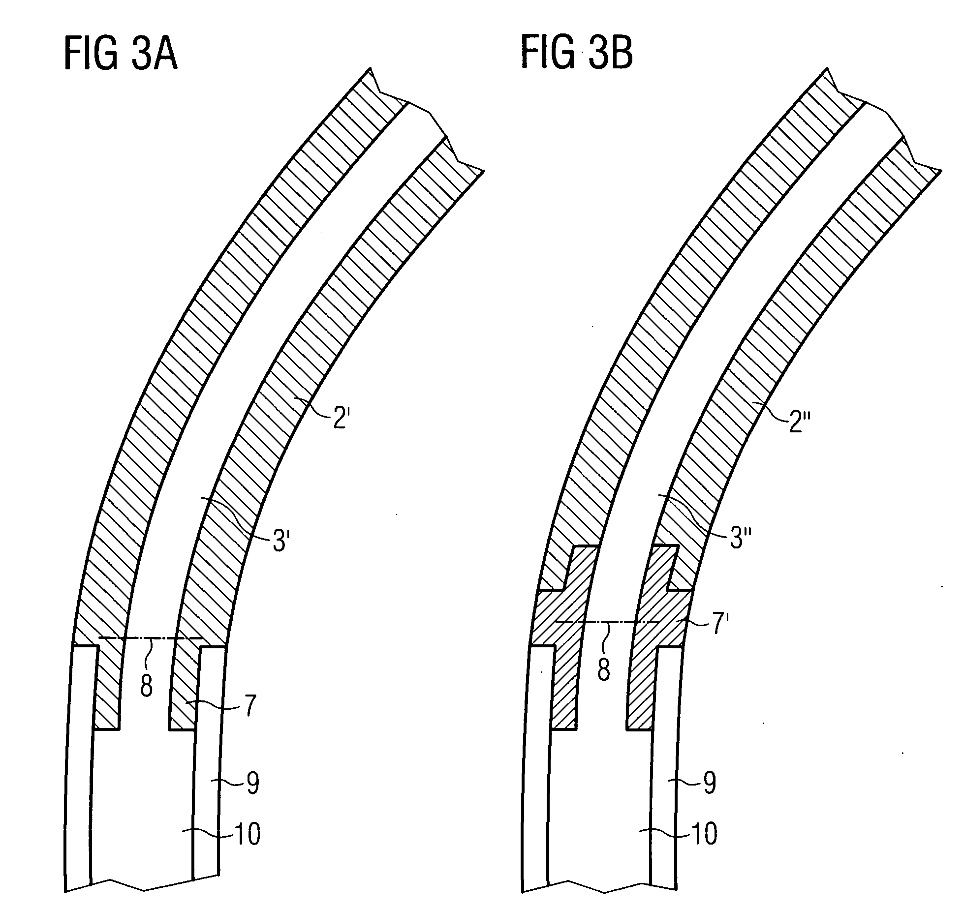 Hearing aid with acoustic damper