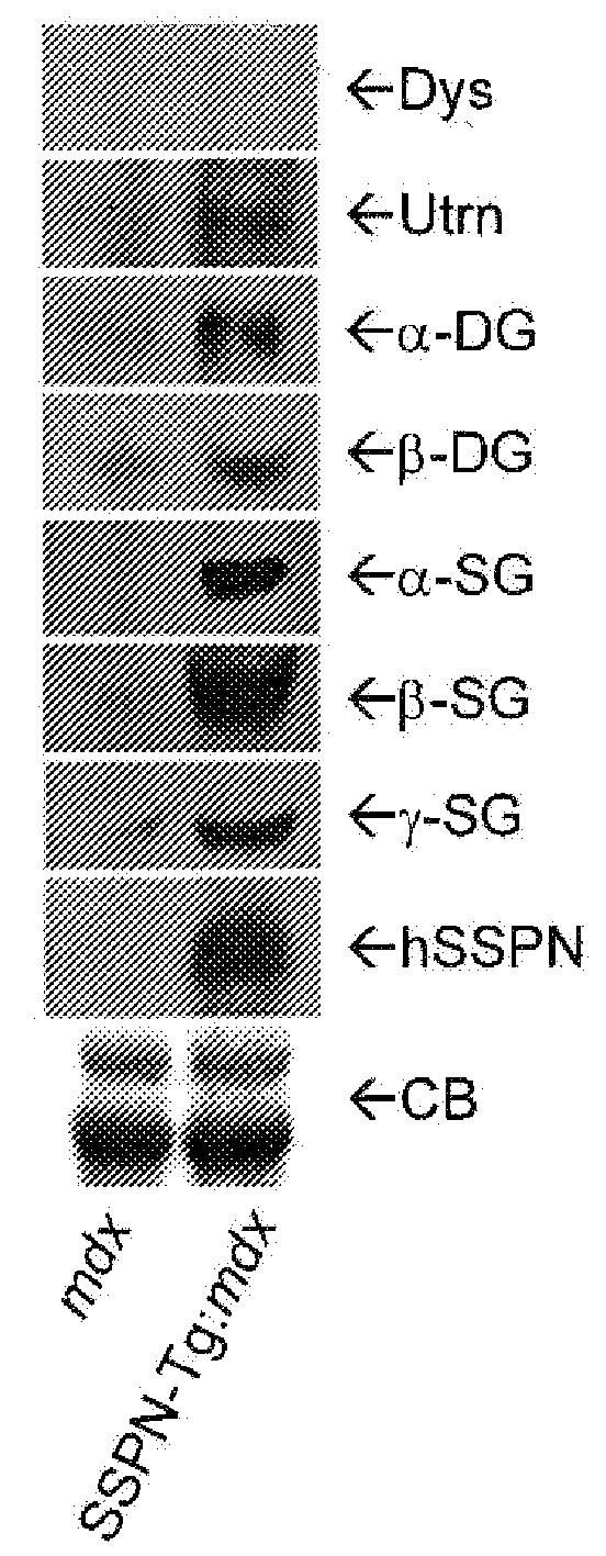 Composition and Methods for the Treatment of Duchene Muscular Dystrophy