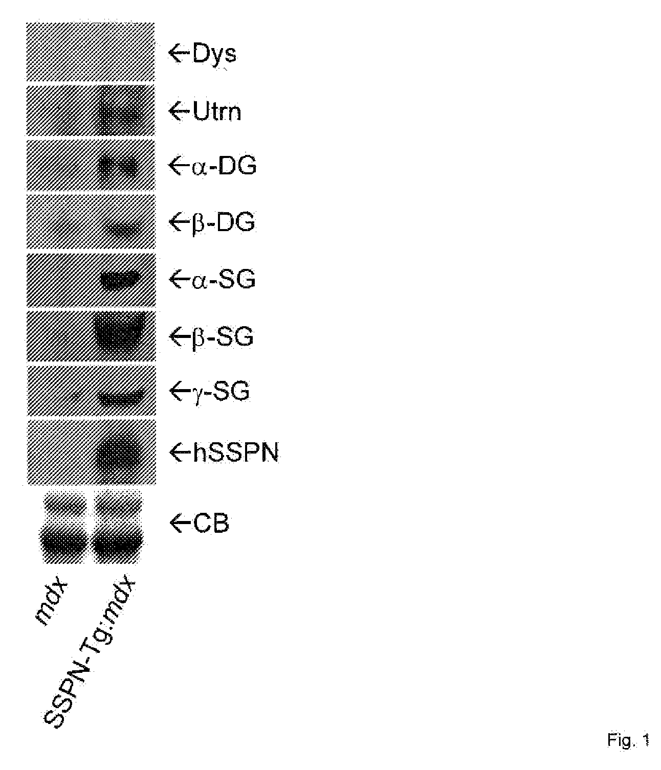 Composition and Methods for the Treatment of Duchene Muscular Dystrophy