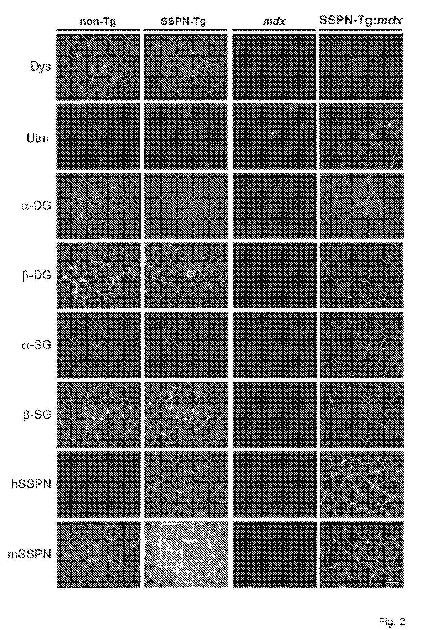 Composition and Methods for the Treatment of Duchene Muscular Dystrophy