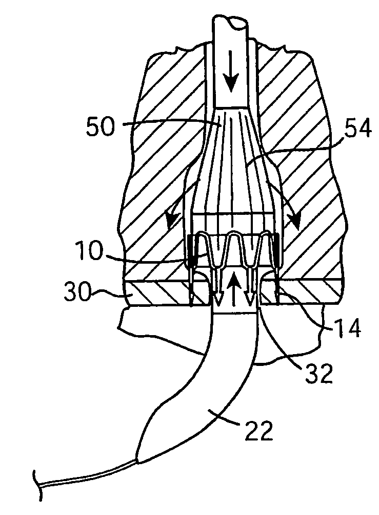 Blood vessel closure clip and delivery device