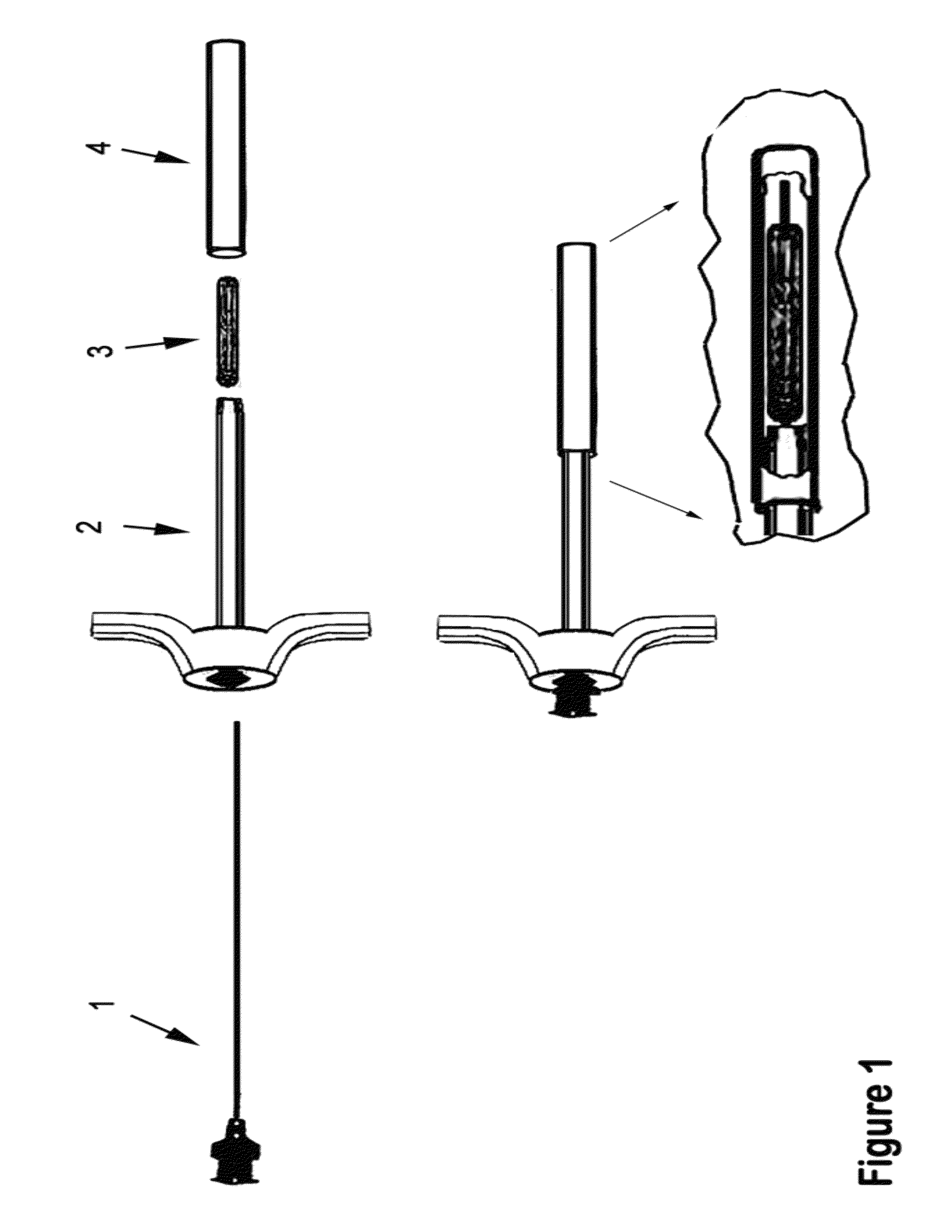 Therapeutic material delivery system for tissue voids and cannulated implants