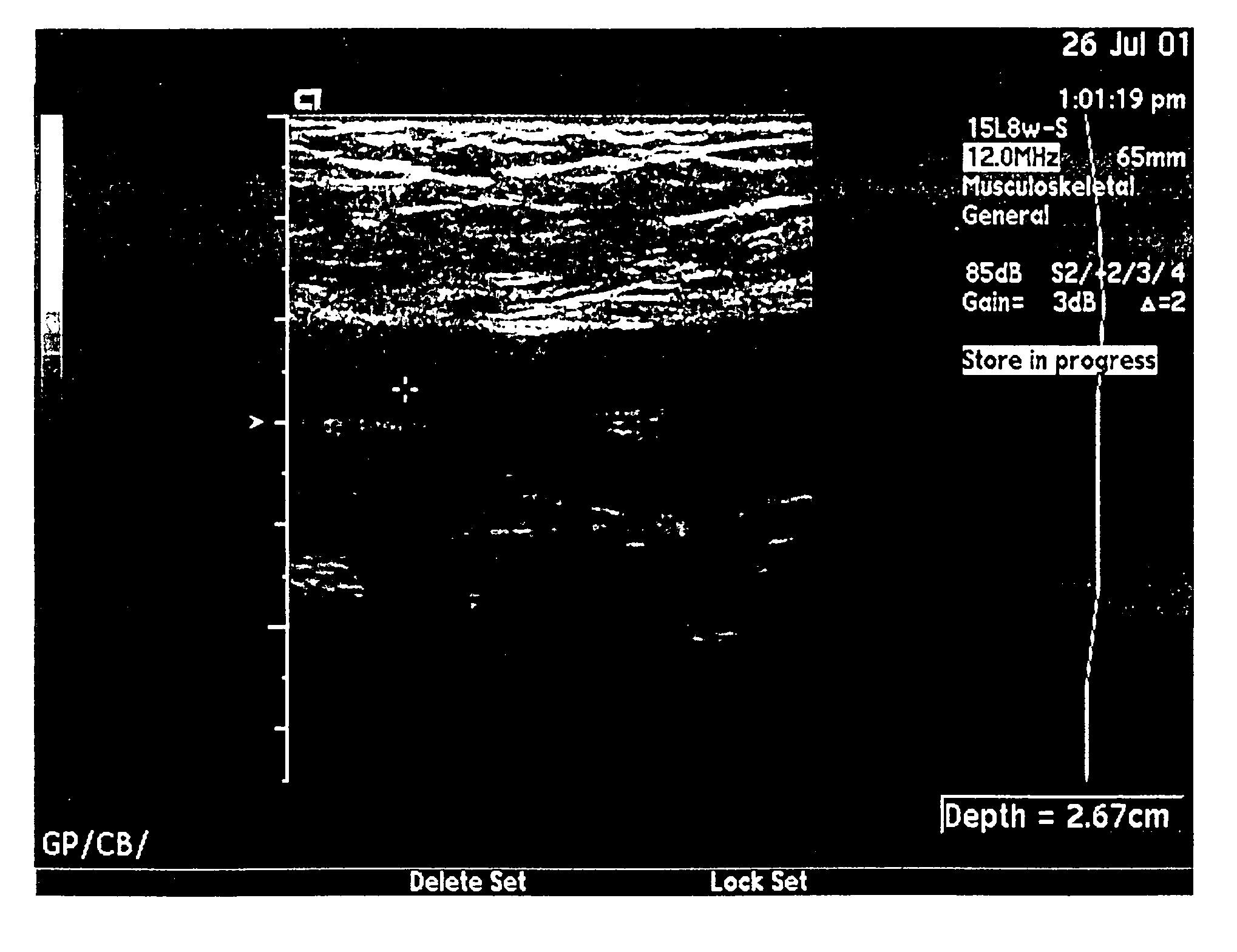 Hemostatic compositions and uses therefor