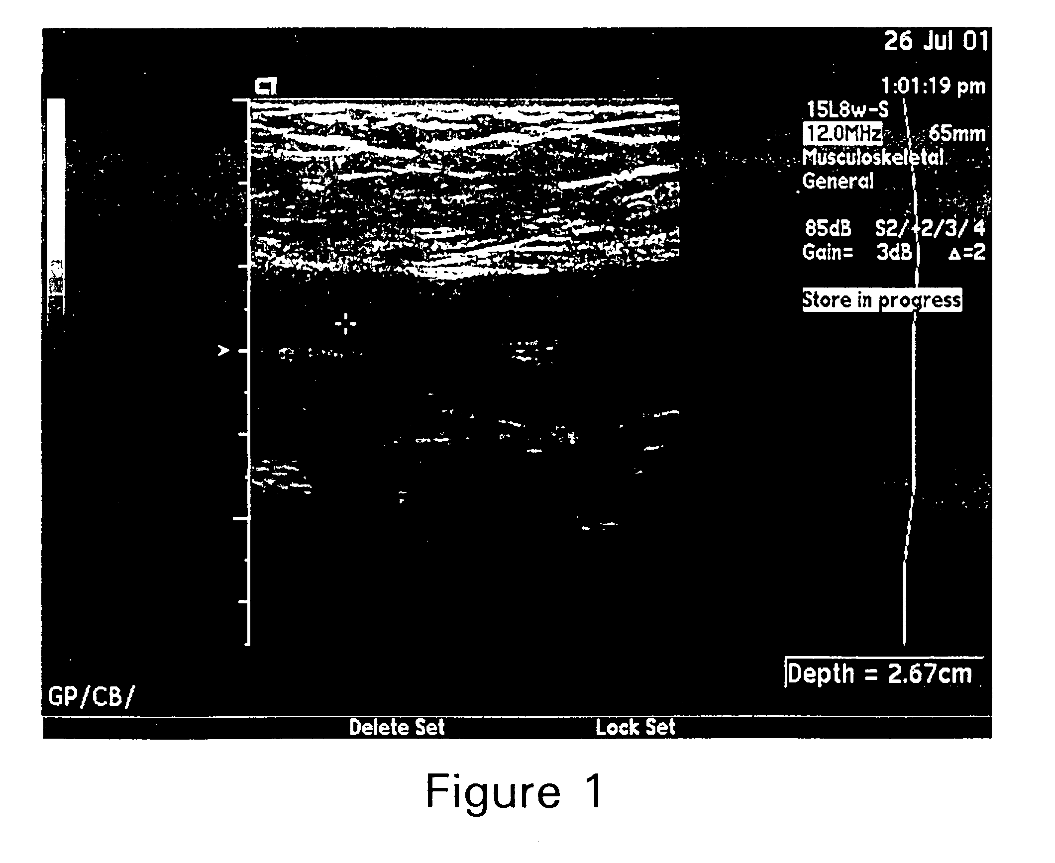 Hemostatic compositions and uses therefor