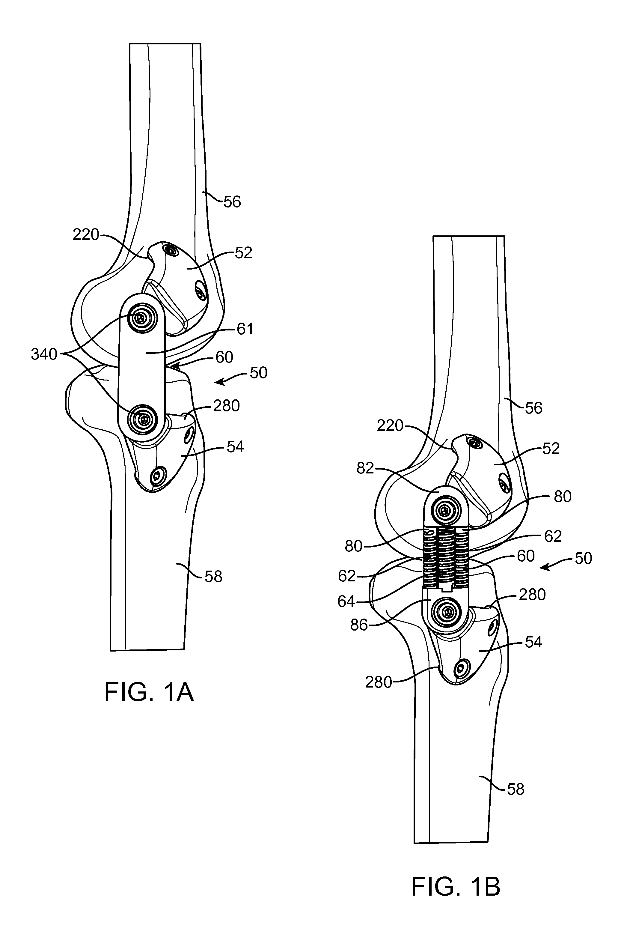 Implantation Approach and Instrumentality for an Energy Absorbing System