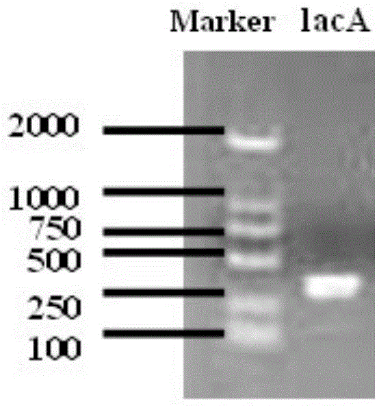 Cordyceps sinensis hirsutella-sinensis laccase, encoding gene and application of two