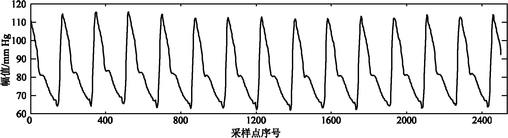 Method for identifying dicrotic notch point in arterial tension signal