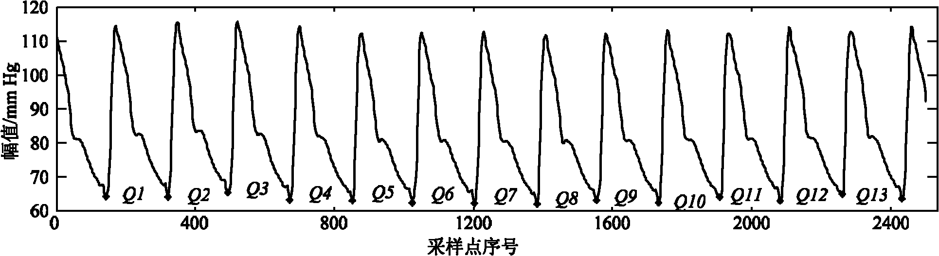 Method for identifying dicrotic notch point in arterial tension signal