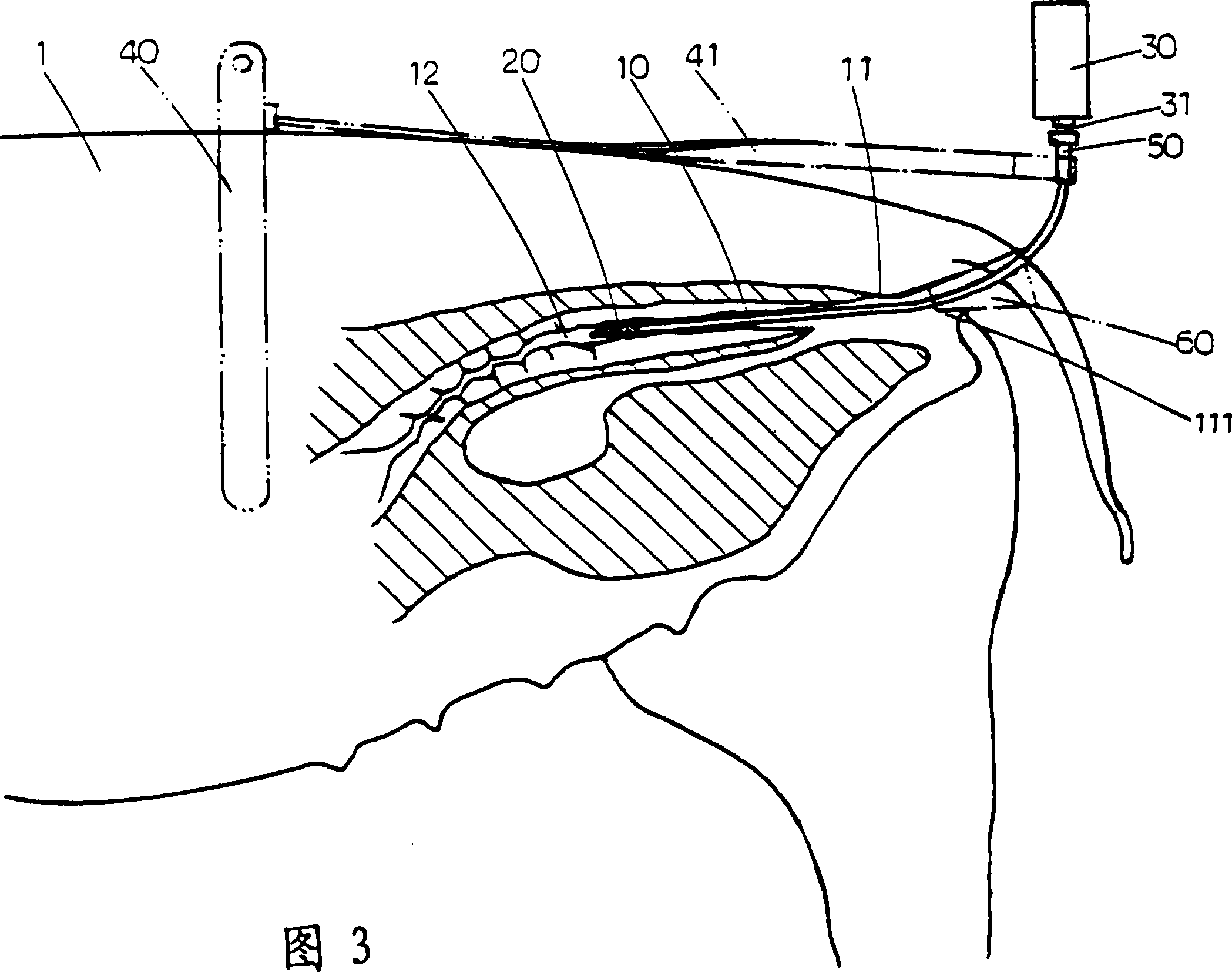 Artificial trace insemination device for animal
