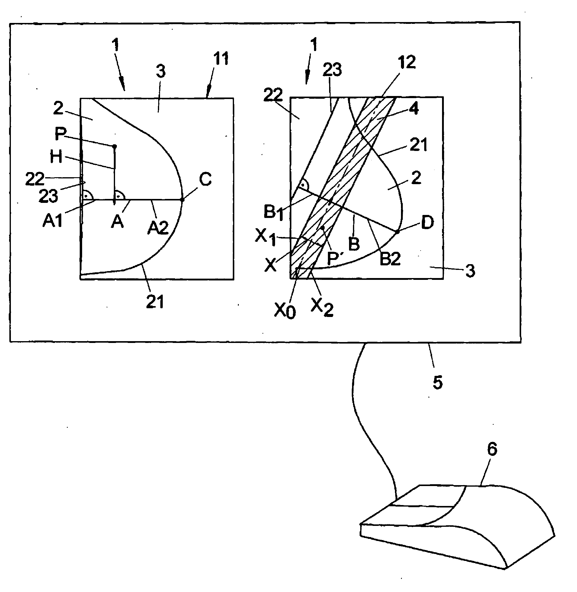 Method and Apparatus for Improved Display of Digital Mammographic Images