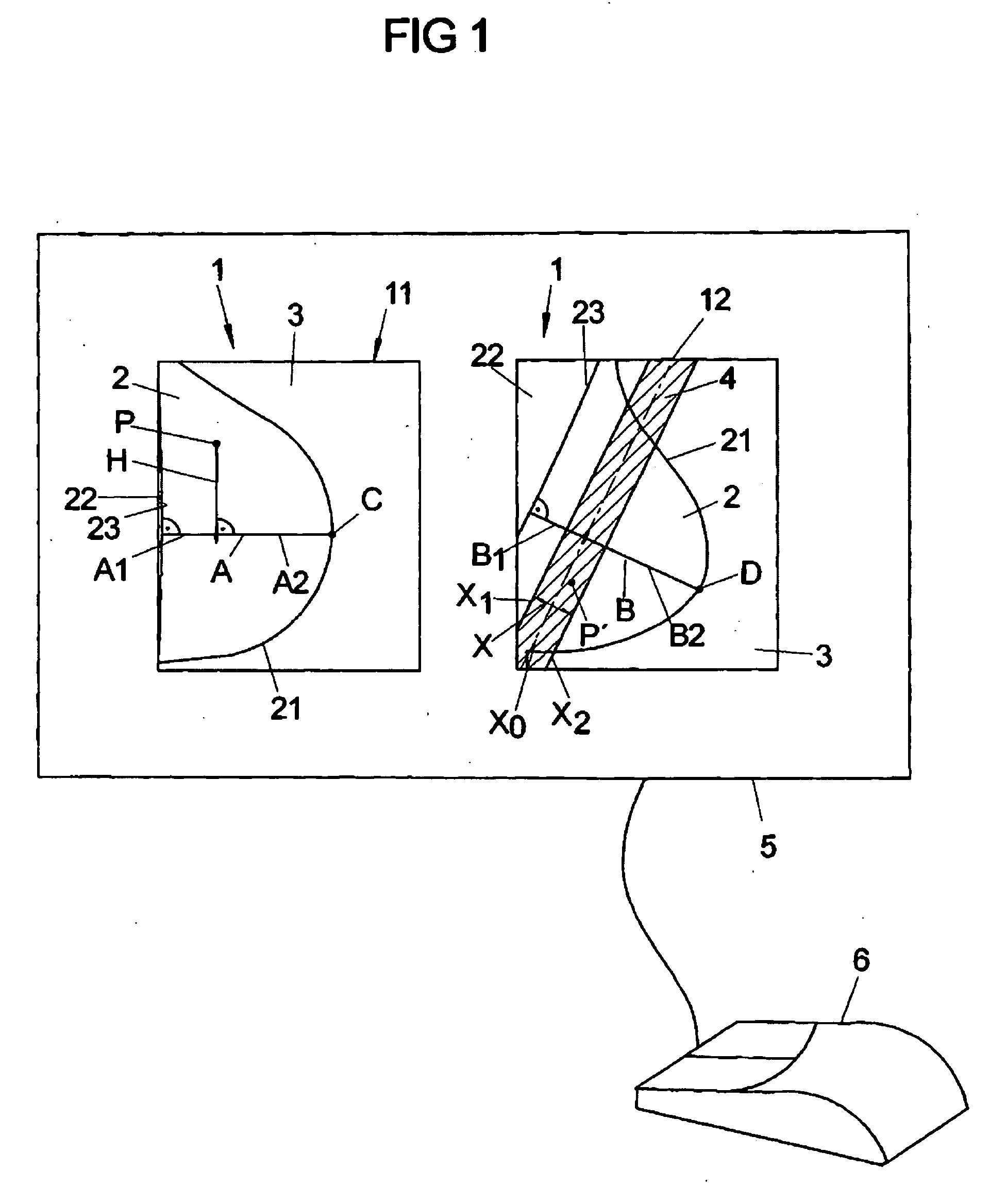 Method and Apparatus for Improved Display of Digital Mammographic Images