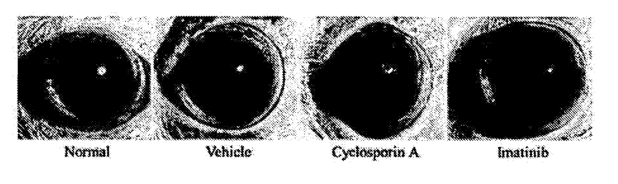 Pharmaceutical composition for preventing and treating dry eye diseases, containing imatinib as active ingredient