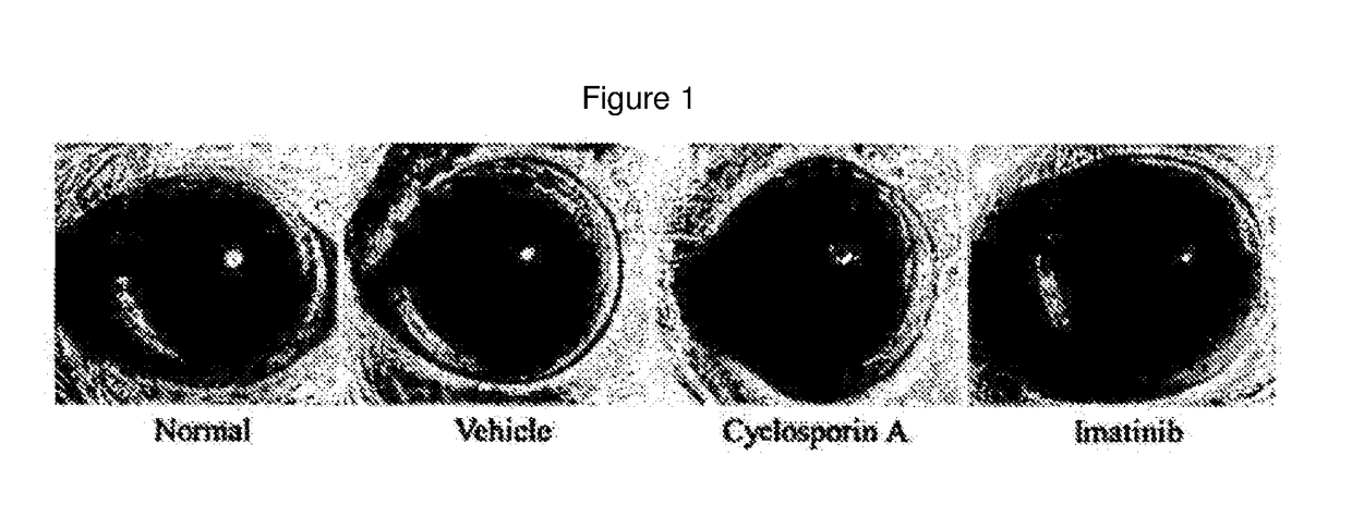 Pharmaceutical composition for preventing and treating dry eye diseases, containing imatinib as active ingredient