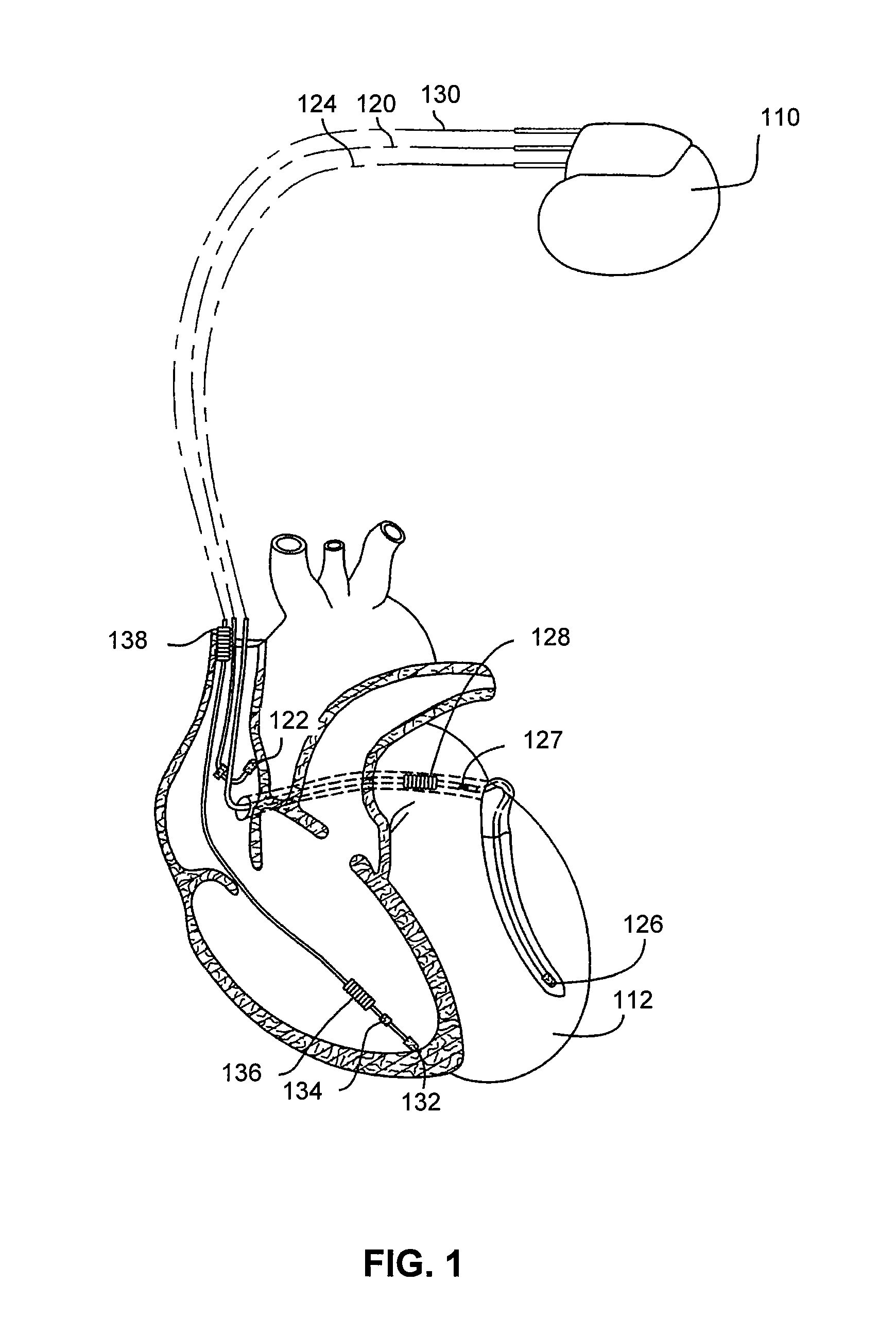 Methods and systems to monitor venous blood oxygen saturation