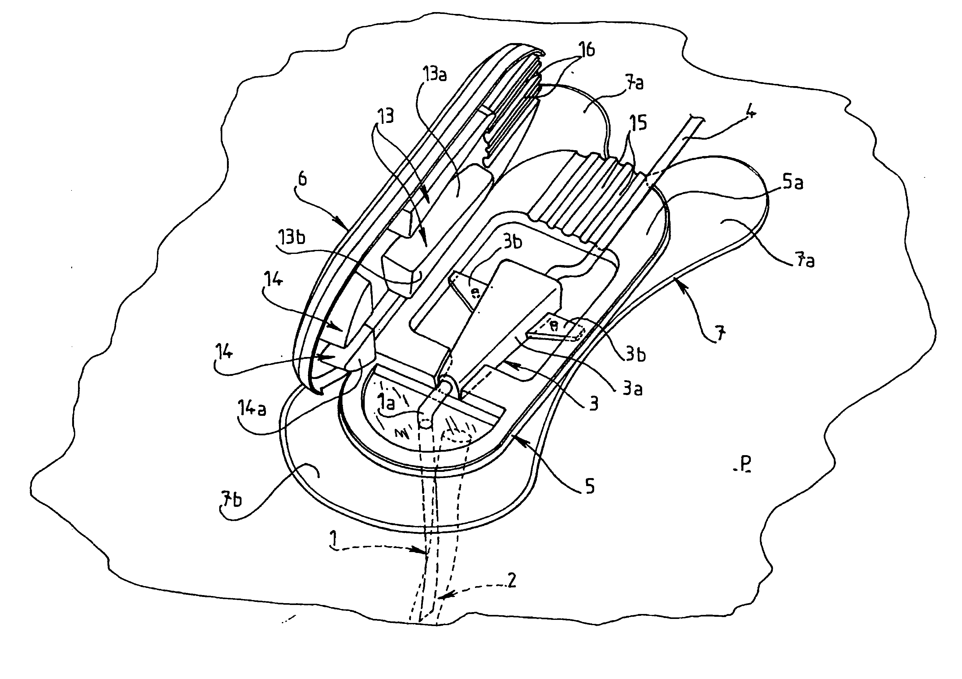 Device for fixing a catheter to the body of a patient