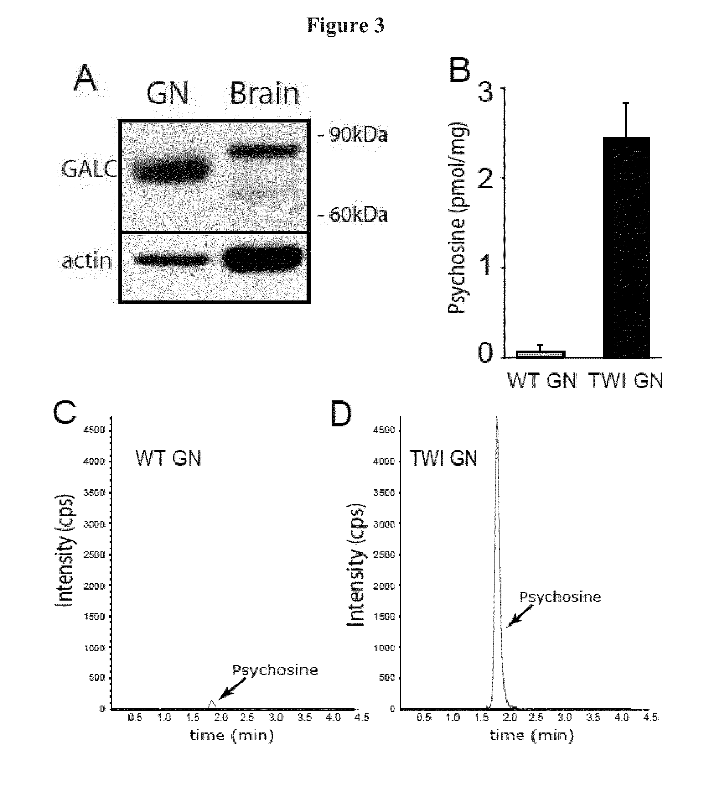 Compositions and methods for the treatment of krabbe and other neurodegenerative diseases