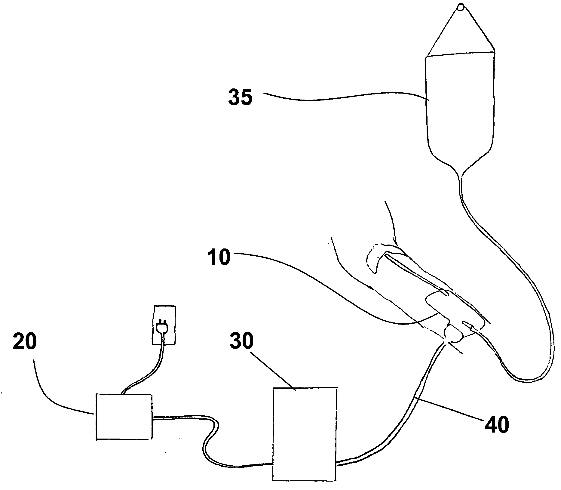Patient infusion media warmer and method of use