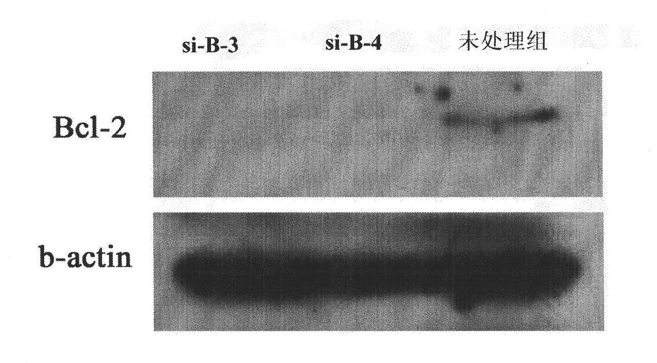 SiRNA molecule for interfering expression of Bcl-2 gene and application thereof