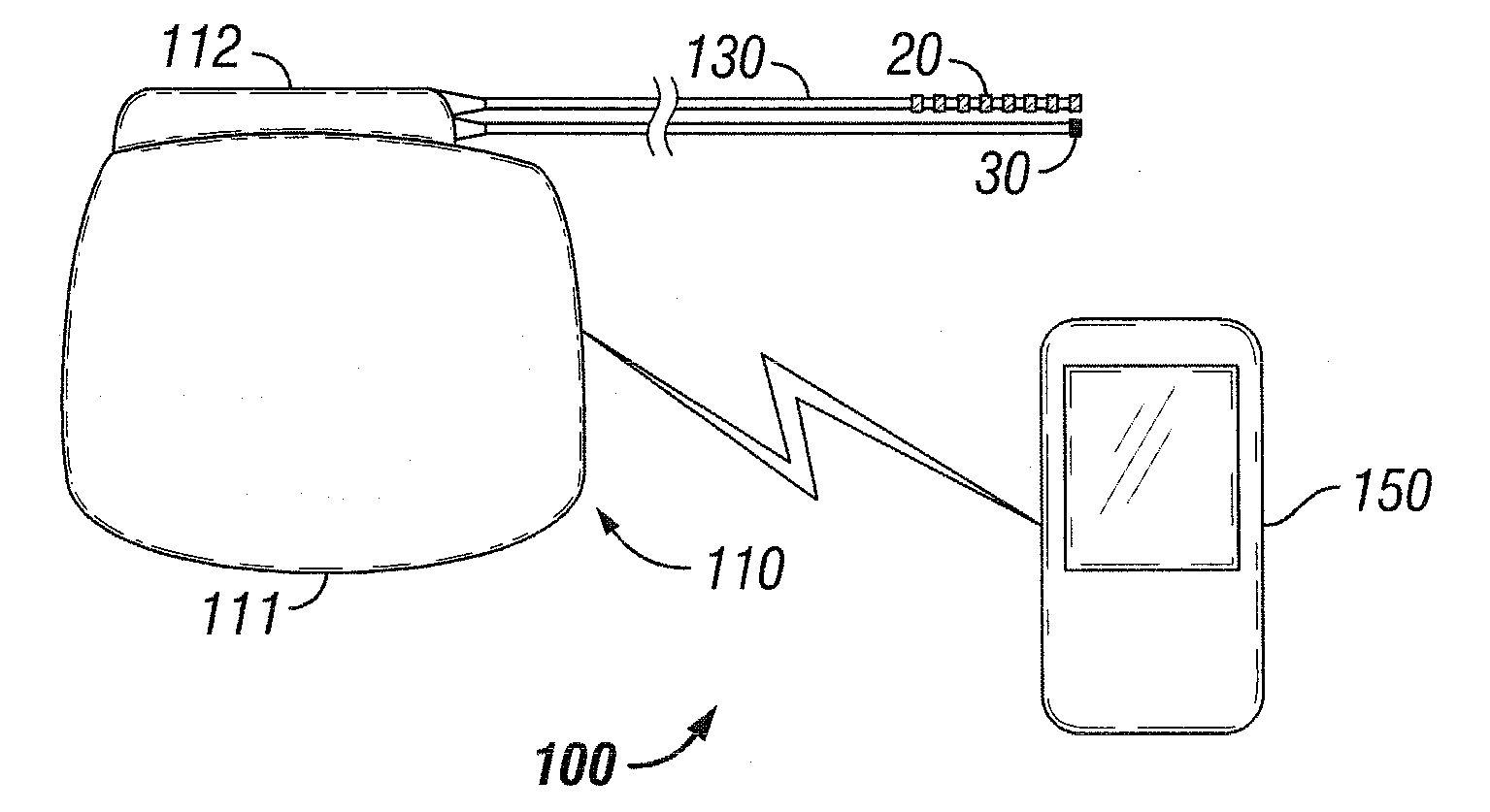 Method for selecting electrodes for deep brain or cortical stimulation and pulse generator for deep brain or cortical stimulation