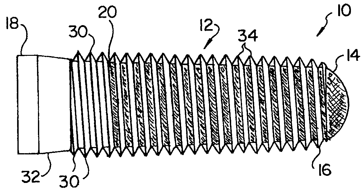 Porous implant with non-porous threads