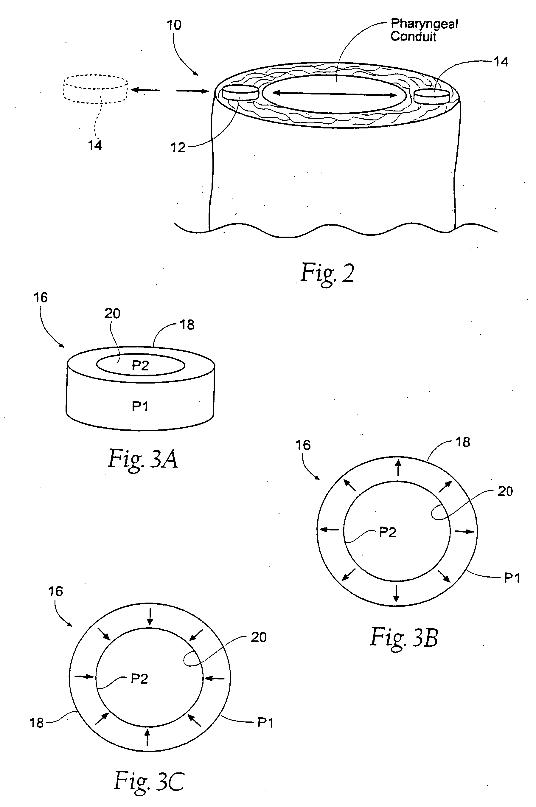 Magnetic force device, systems, and methods for resisting tissue collapse within the pharyngeal conduit