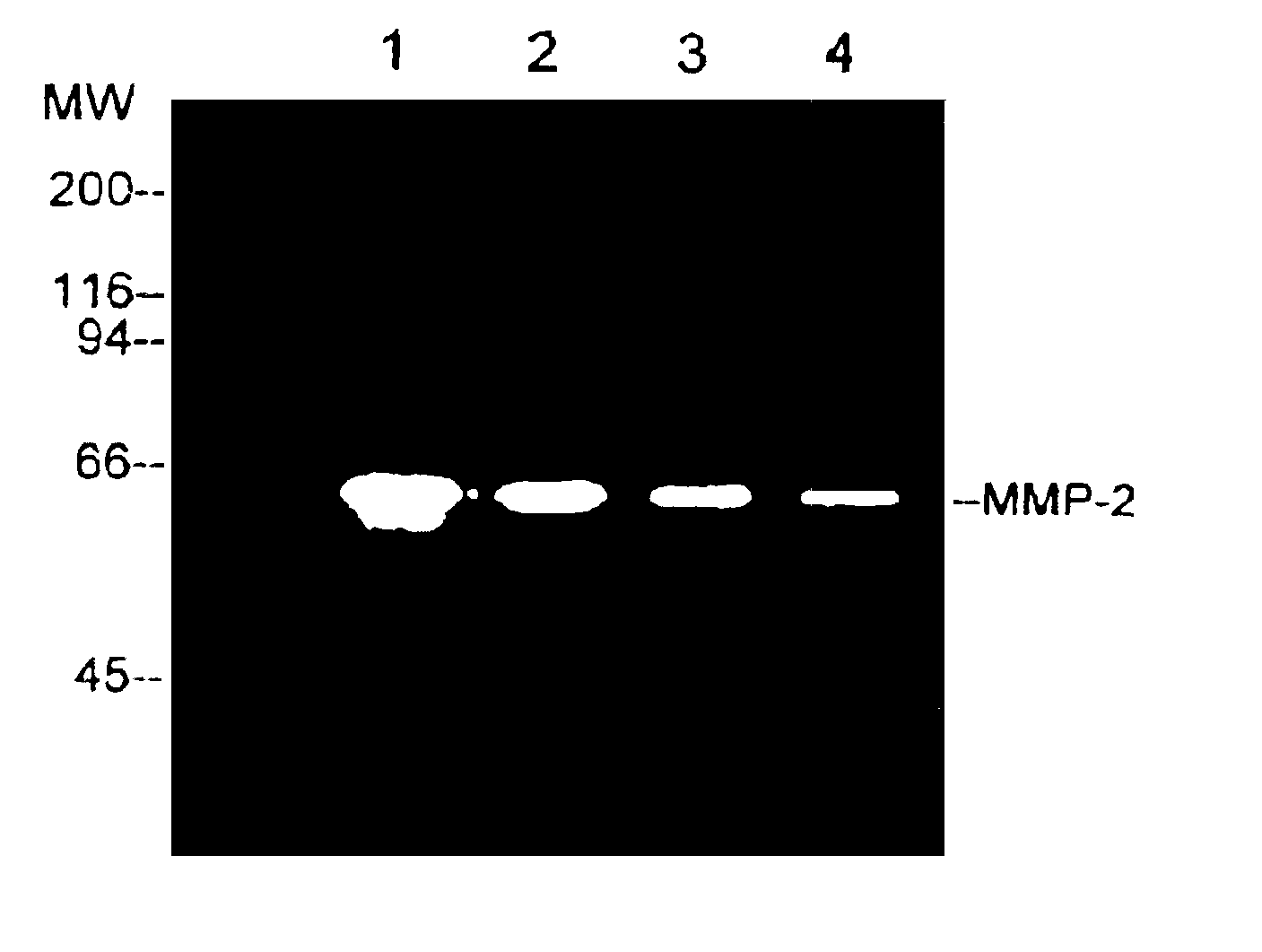 Matrix metalloproteinase and tumor necrosis factor inhibitors