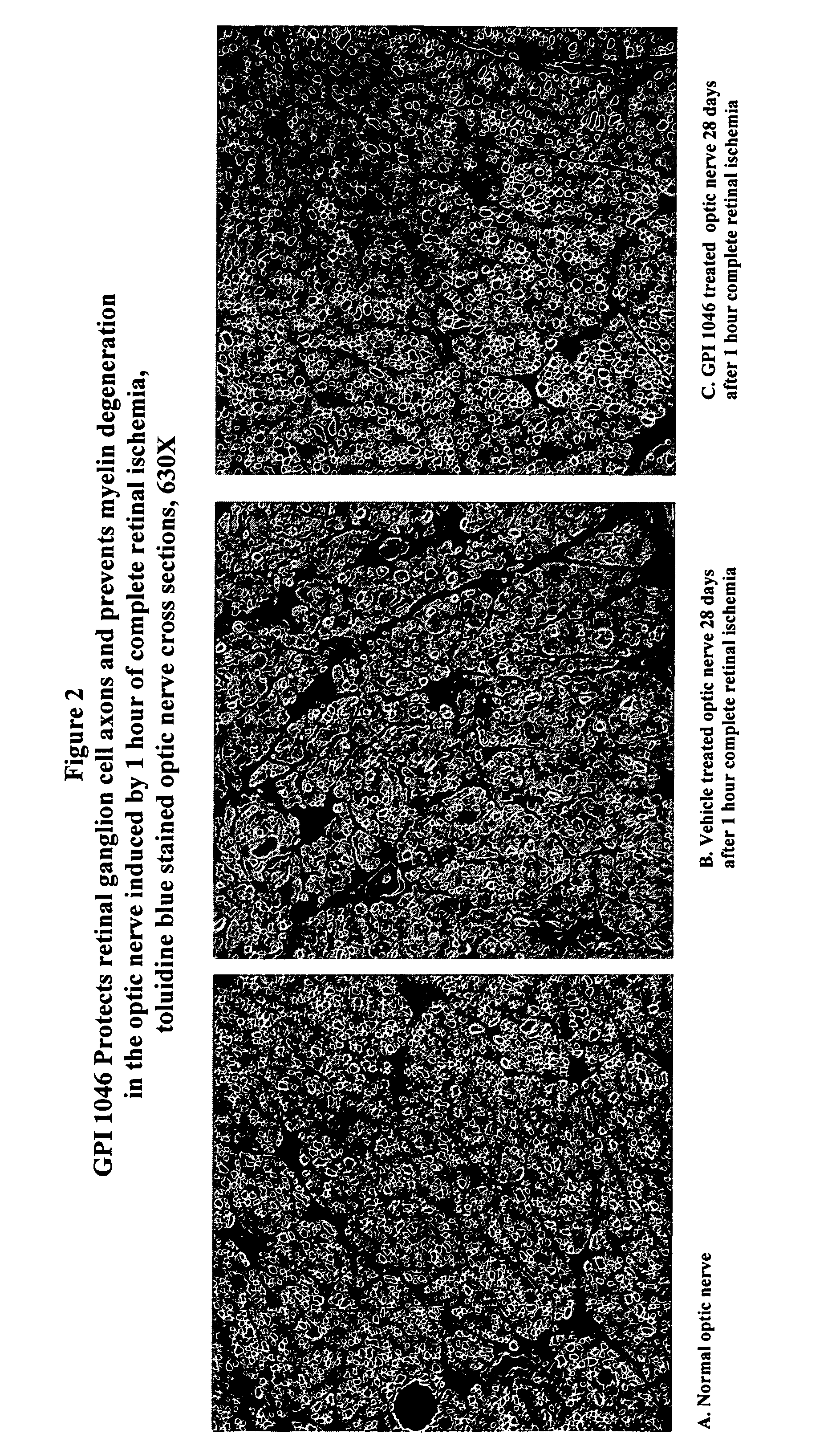 Carboxylic acids and carboxylic acid isosteres of N-heterocyclic compounds for vision and memory disorders