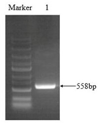 Pseudo-ginseng WRKY transcription factor gene PnWRKY9 and application thereof