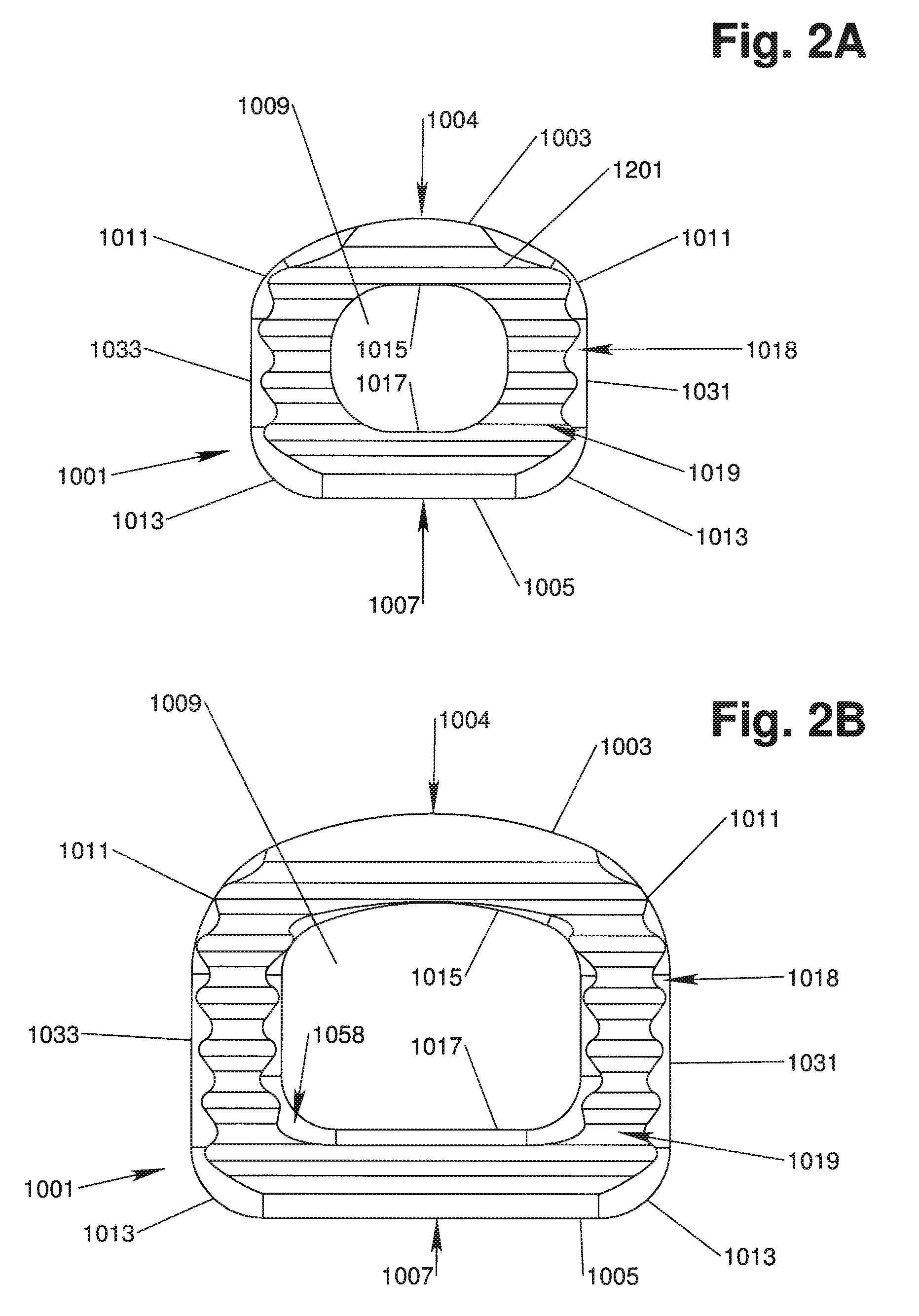 Intervertebral implant devices for supporting vertebrae and devices and methods for insertion thereof