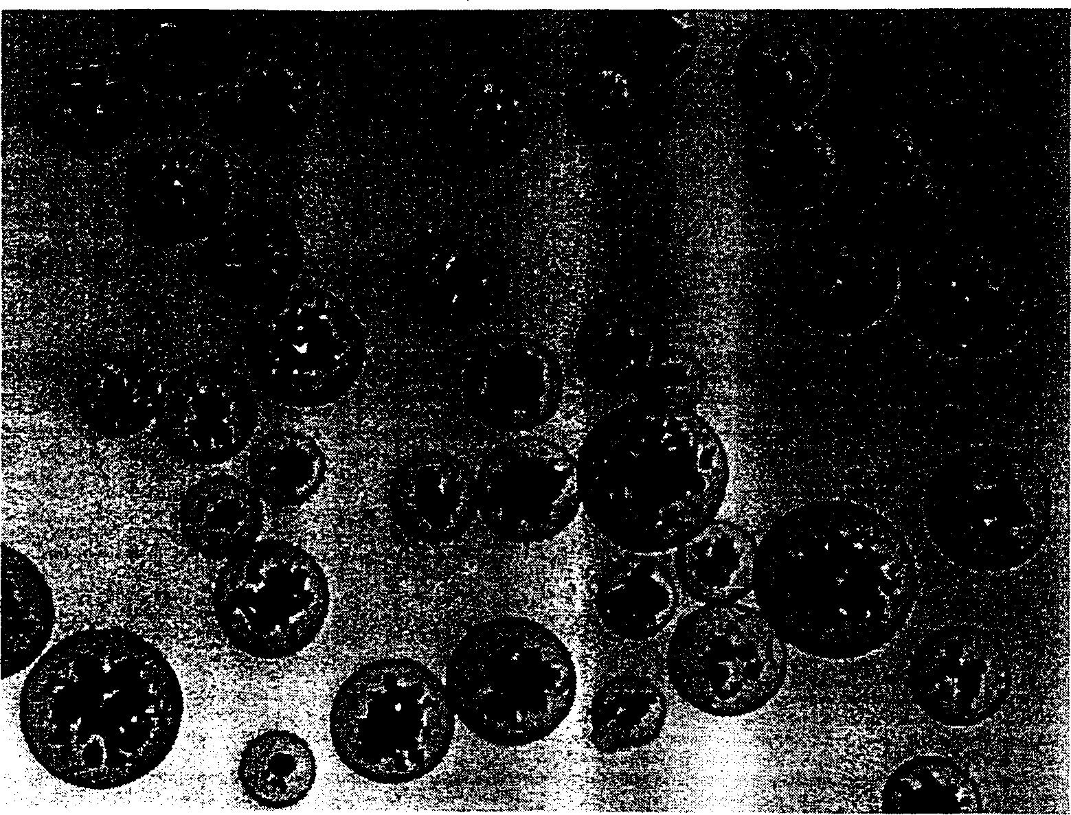 Putamen pattern cellulose stainless steel powder compounded microballons and the preparation process thereof