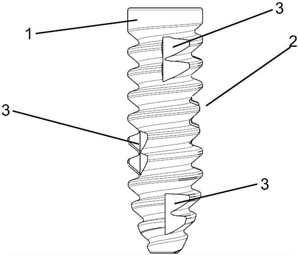 Reinforcing interface nail