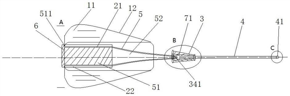 Novel deformable implantable infusion port and use method thereof