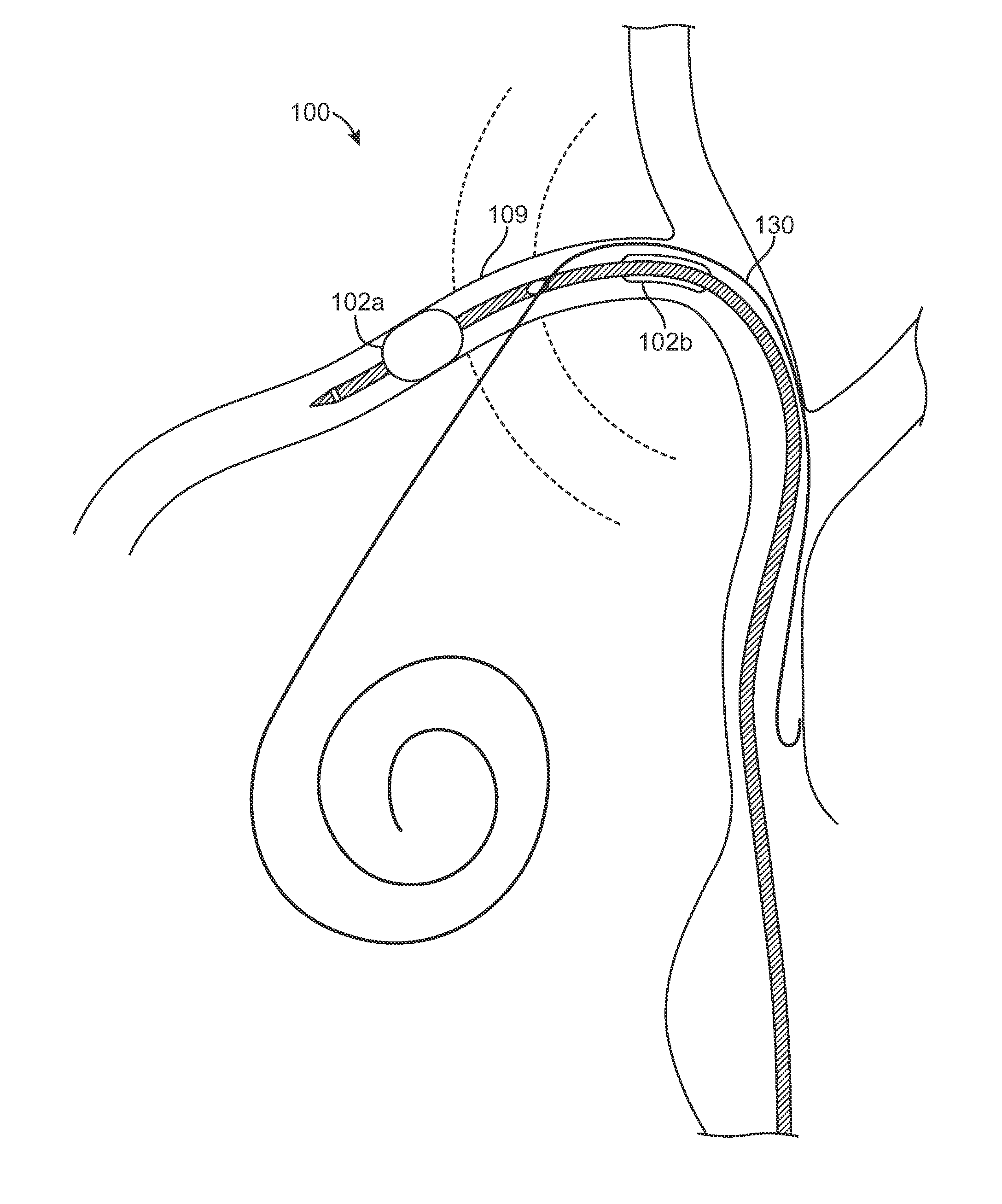 Method and device for inserting electrical leads