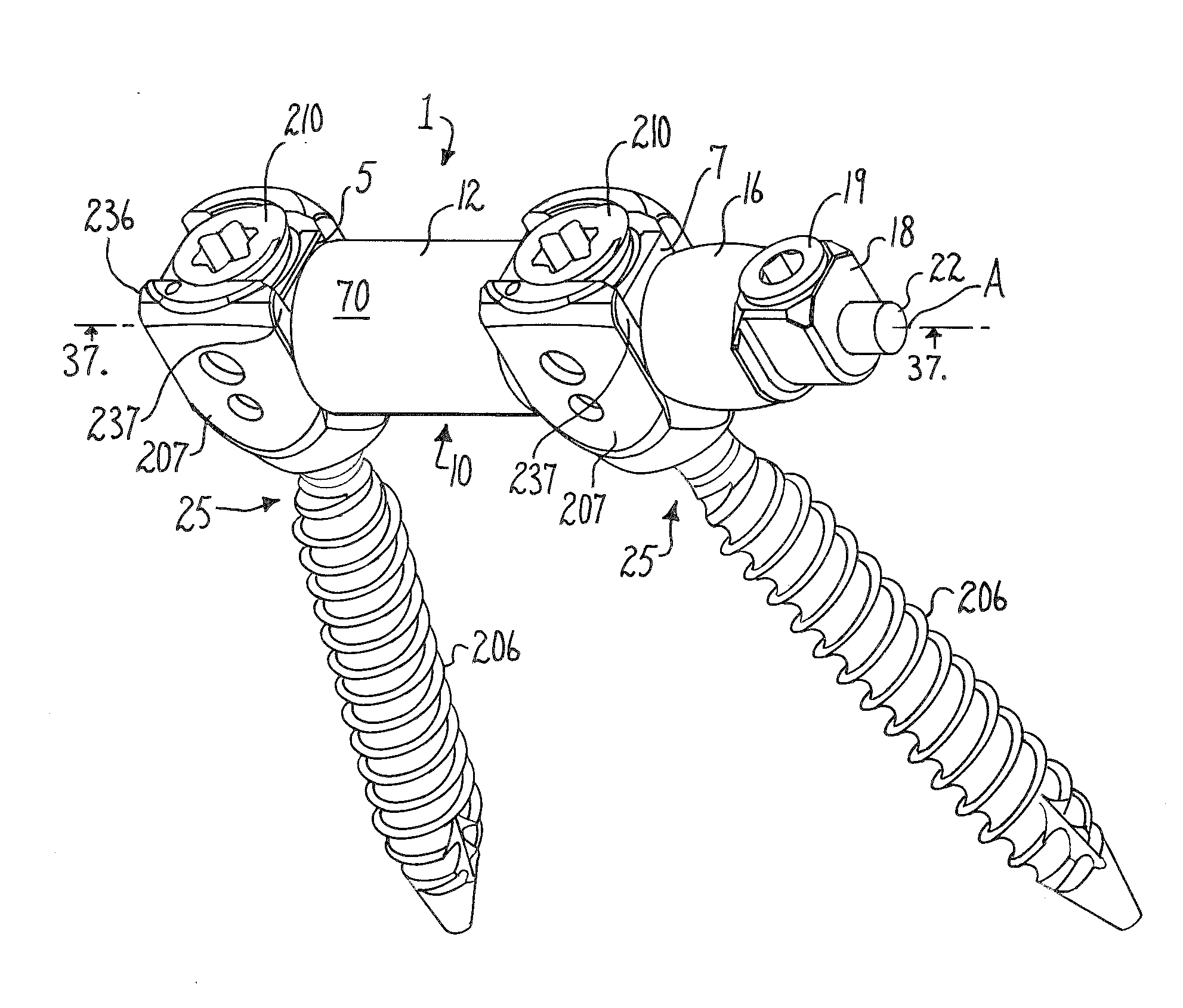 Longitudinal connecting member with sleeved tensioned cords