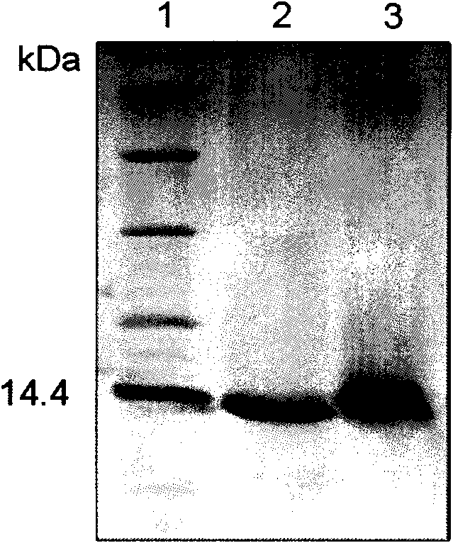 Human plasminogen K5 modified by RGD and preparation method and application thereof