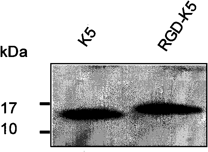 Human plasminogen K5 modified by RGD and preparation method and application thereof