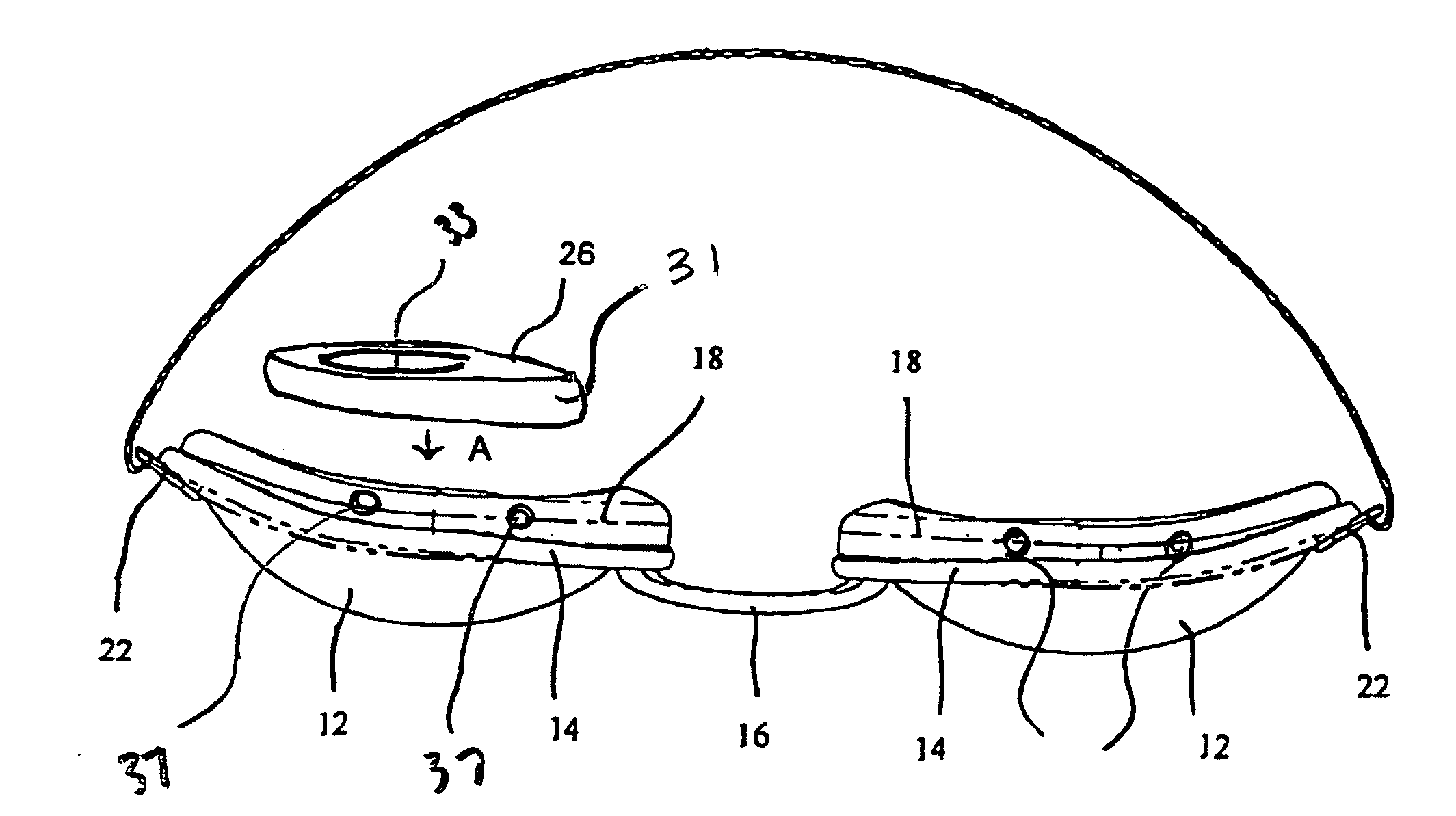 Apparatus, system and method for treating dry eye conditions and promoting healthy eyes