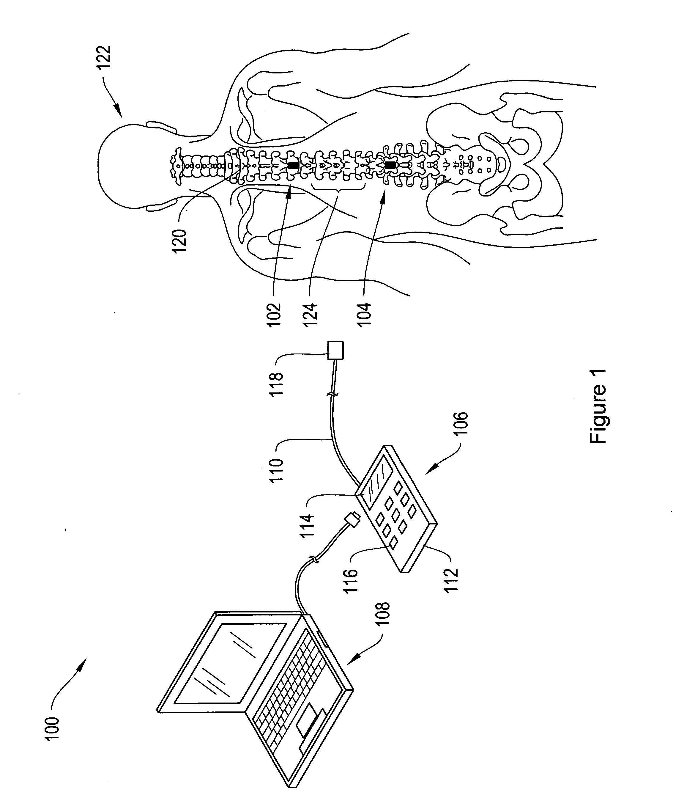 Spinal cord implant systems and methods