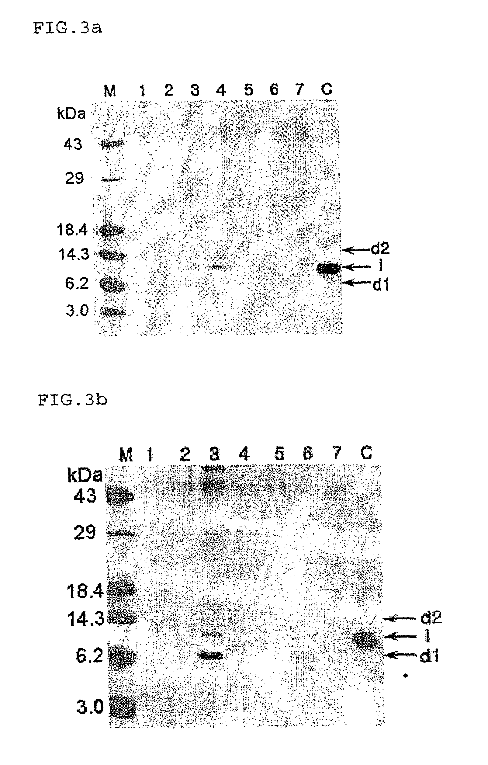 Yeast transformant producing recombinant human parathyroid hormone and method for producing the hormone