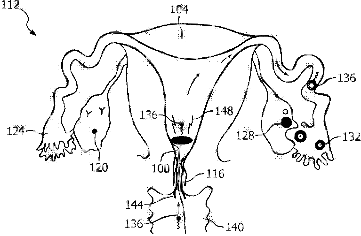 Intrauterine electronic capsule for administering a substance
