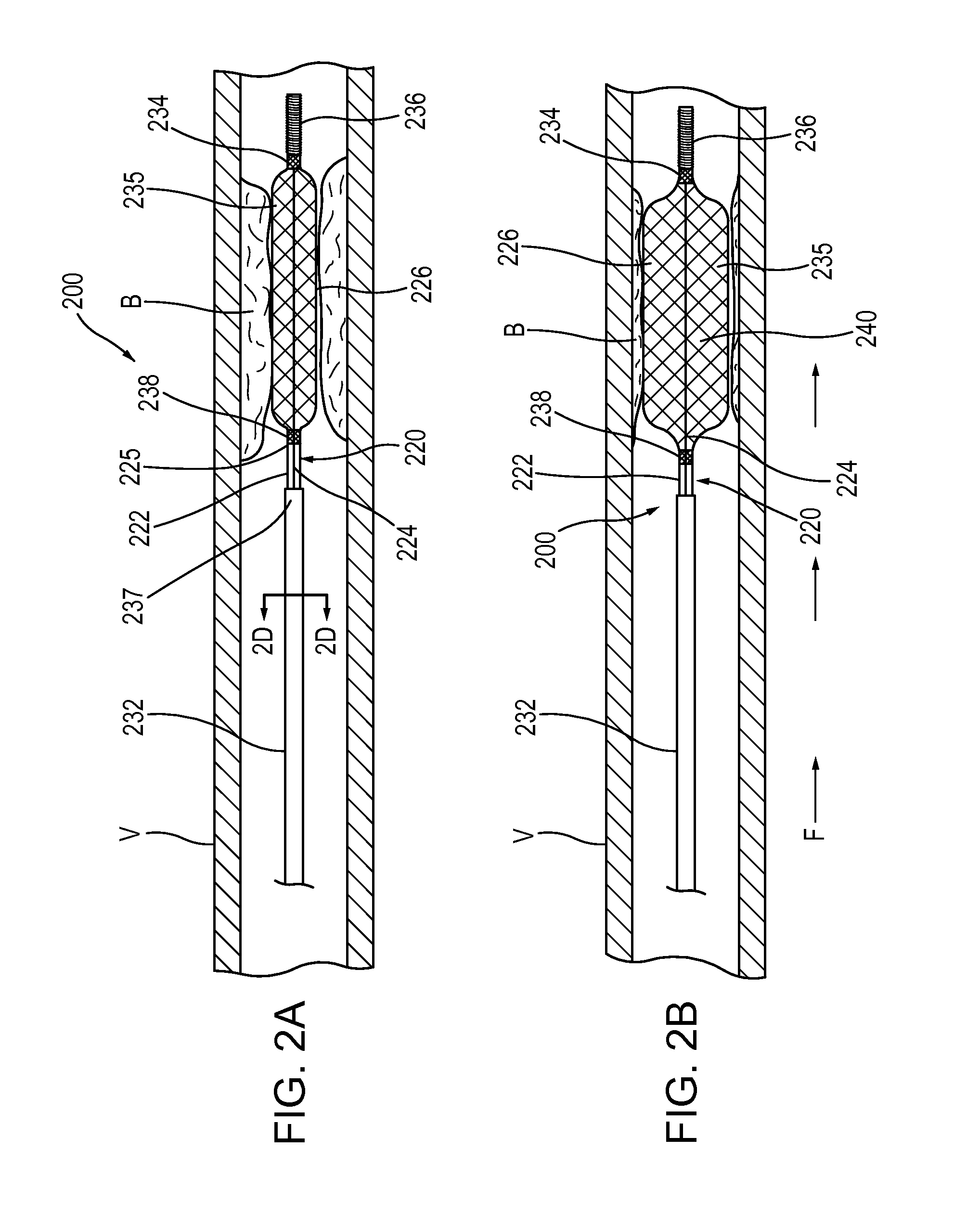 Devices and methods for vascular recanalization