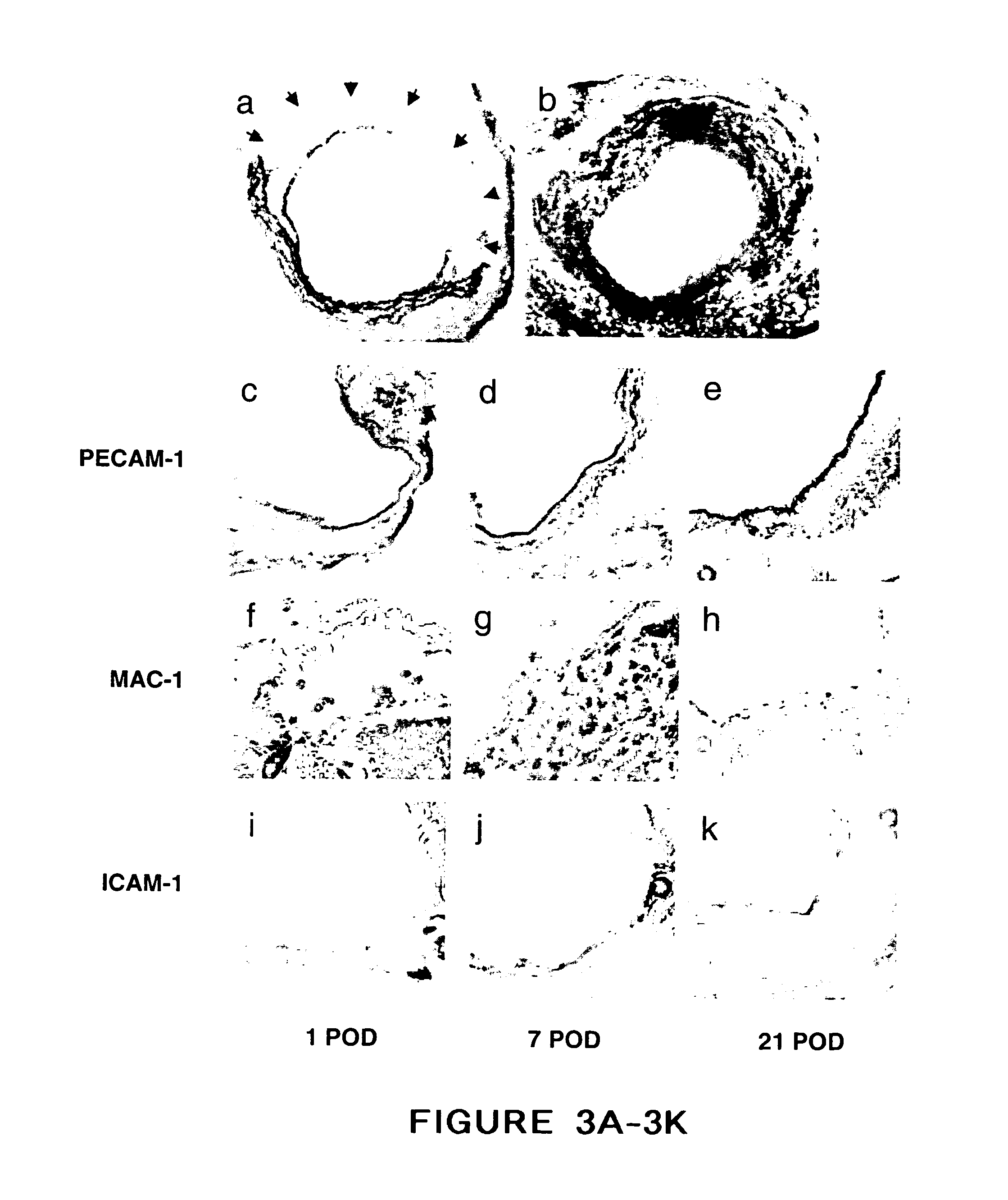 Compositions and methods for ex vivo preservation of blood vessels for vascular grafts using analogues of cAMP and cGMP