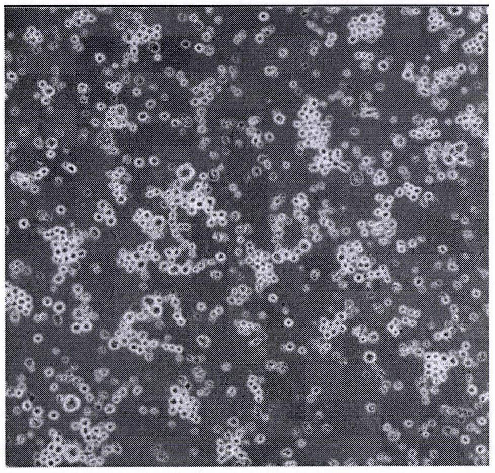 Novel coronavirus gene-silencing immortalized lung stem cell vector vaccine