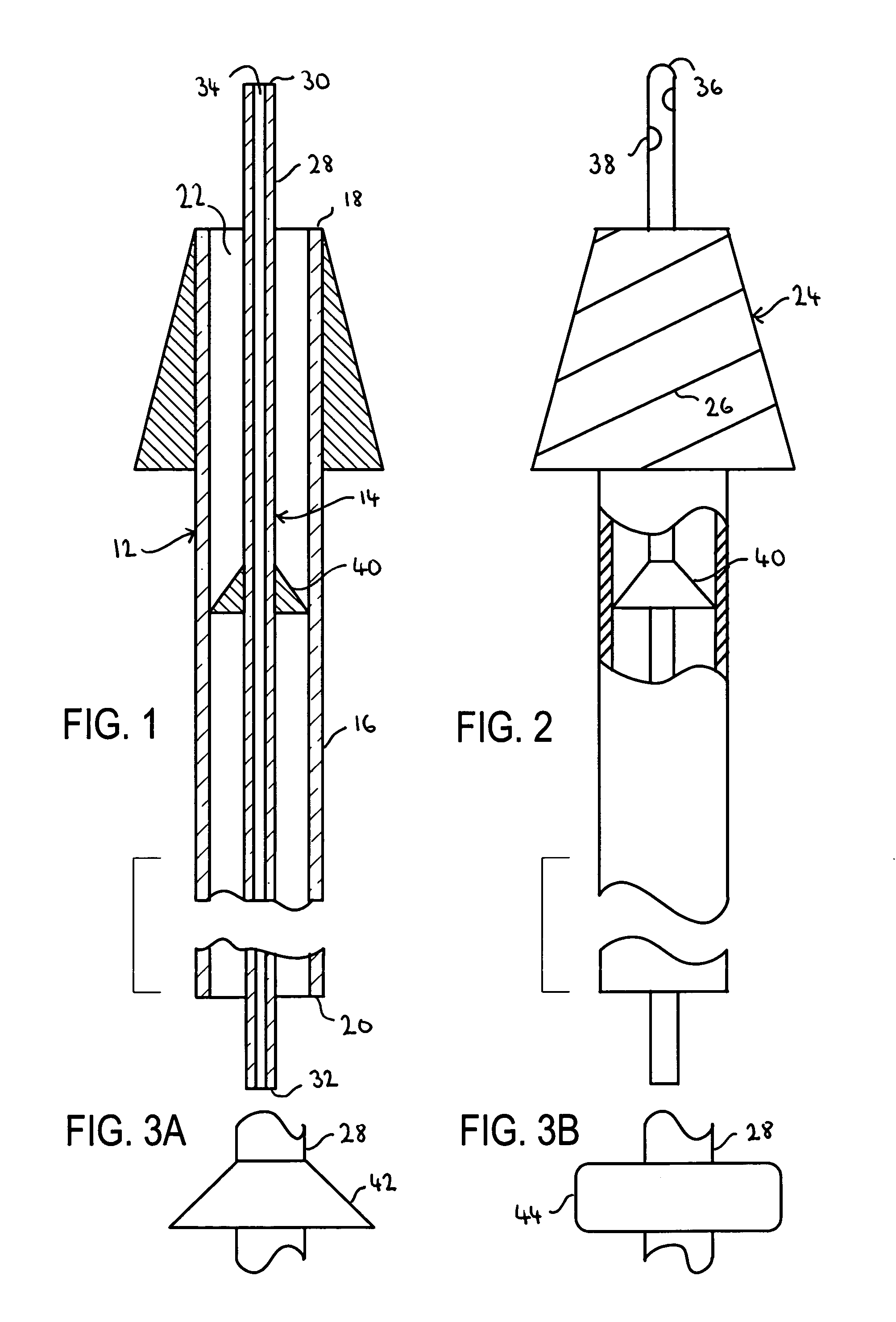 Apparatus and methods for uterine anesthesia