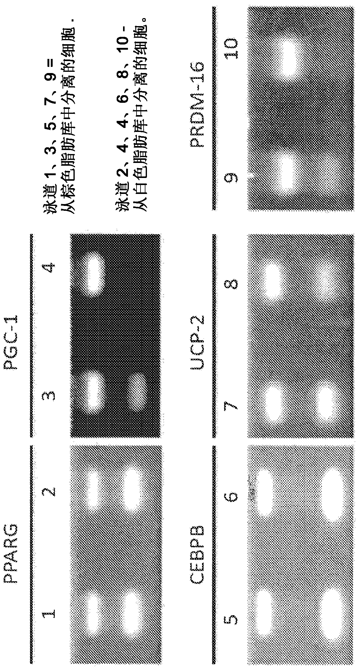 Brown fat cell compositions and methods